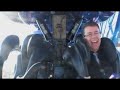 Infusion Reverse POV Infusion Reverse POV