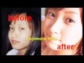 2NE1 整容plastic surgery