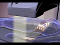 DEXA - Dual Energy X-Ray Absorptiometry