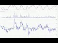 Dec 14th Watch List Day Trader Radio.com Dec 14th Watch List Day Trader Radio.com
