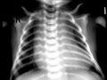 drink milk. prevent osteoperosis