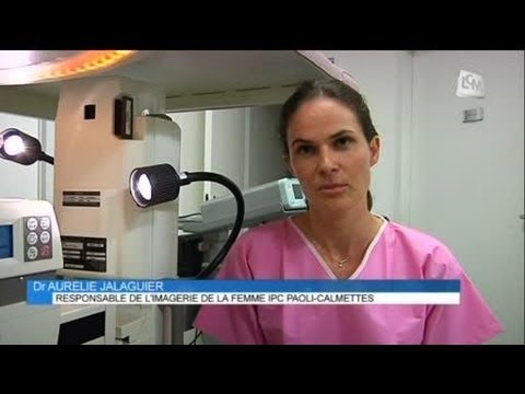 cancer du sein diagnostic