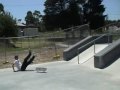 Knoxy Knox Clip