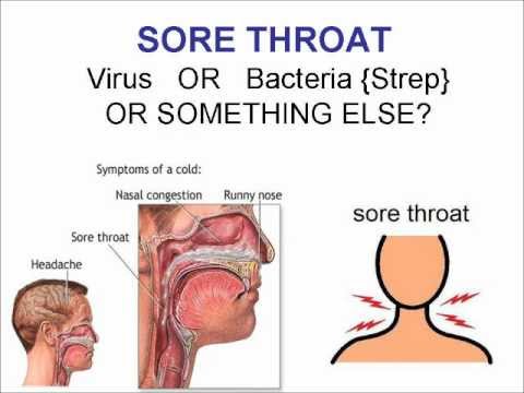 how to relieve viral sore throat