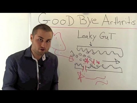 how to relieve arthritis