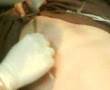 piercing au teton