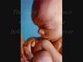 videos de Teen pregnancy