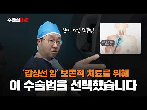 '갑상선암' 보존적 치료를 위해 '이 수술법' 을 선택했습니다 (로봇수술 SP..