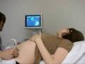 My Ultra Sound. My Baby...... 7 weeks and 4 Days