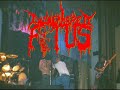 DISMEMBERED FETUS INTRO TO JOSH TRIBUTE SHOW