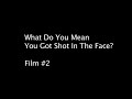 What Do You Mean You Got Shot In The Face? #2