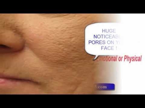 how to cure pores on face