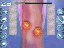 Trauma center under the knife 2 walkthrough operation 9