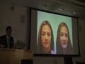 DALLAS PLASTIC SURGERY:LECTURE ON RESTYLANE PERLANE RADIESSE