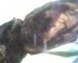 Feto