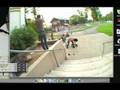 30mm death