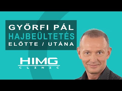 YouTube előnézeti kép