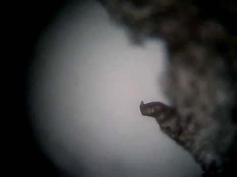 how to treat d. folliculorum