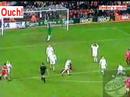 hit by ball hit by ball