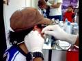 stretching ear 3mm