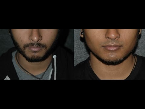 how to get more jaw definition