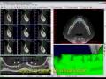 videos de Bioparts - Tutorial 3 DentalSlice: Janela 3D: parte 2 de 2