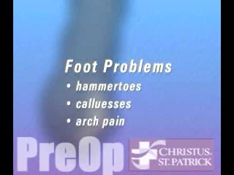 old lady bunions