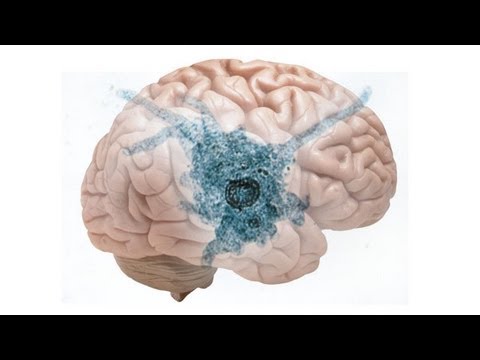 how to treat amoeba