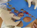 cambio dispositivo ileostomia con eritema cambio dispositivo ileostomia con eritema
