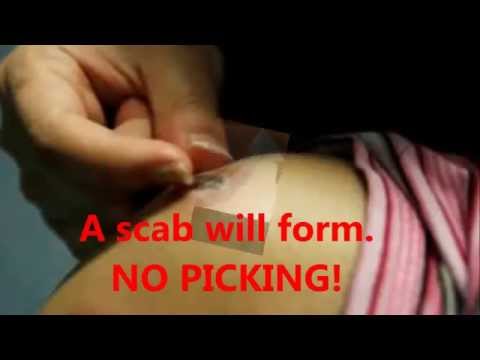 how to relieve after tattoo pain