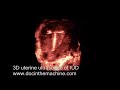 3D ultrasound of IUD in uterus