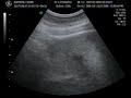Nuestro Bebe a las 15 semanas