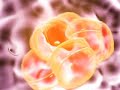 Prostate Cancer
