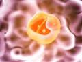 Prostate Cancer