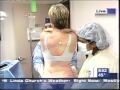 WB 11 TV Power Liposuction by dr bruce katz juva skin & laser center
