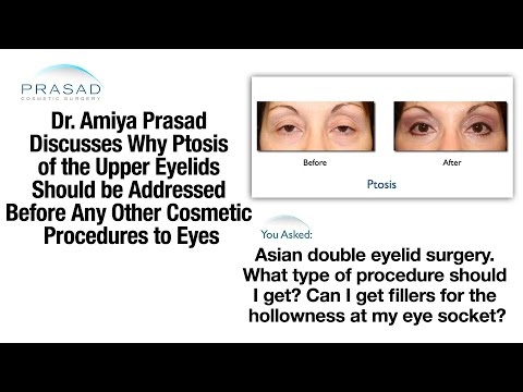 how to cure ptosis naturally