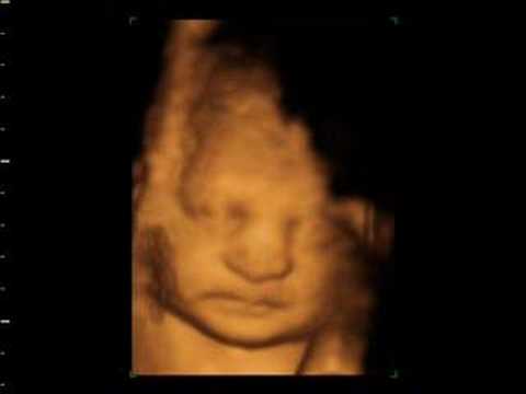 simon scans