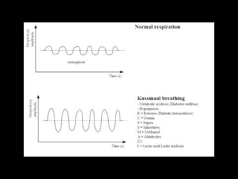 how to treat dka in the er