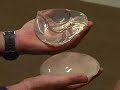 dr  nachbar on silicone gel breast implants