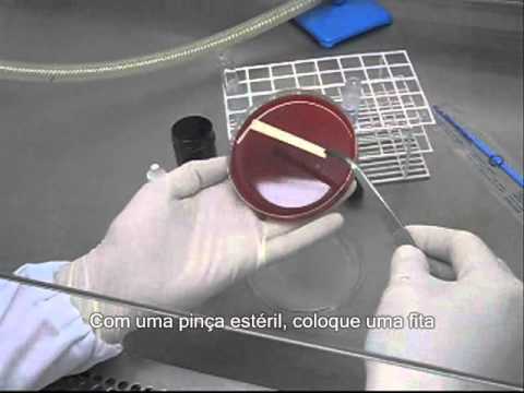 how to isolate streptococcus agalactiae