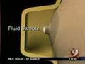 Breast Cancer Research - NeoMatrix