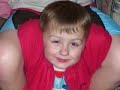 Autism has many faces