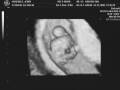 videos de Bebe Cardenas Gonzalez 8S
