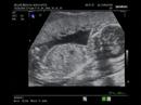Baby Tewes Baby Tewes
