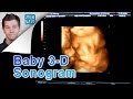 videos de Jack Vale's New Baby 3-D Sonogram