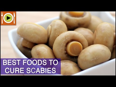 Best Foods to Cure Scabies | Including Vitamins, Antioxidants & Zinc Rich Foods