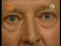 Neues aus der Anstalt - Hornauer ber�t auf Kanal Telemedial