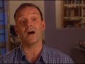 Fluoride Deception Part 2