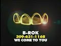 B Rok Gold Teeth Commercial full B Rok Gold Teeth Commercial full