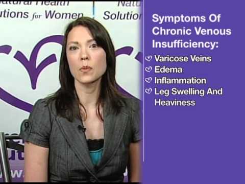 how to treat phlebitis
